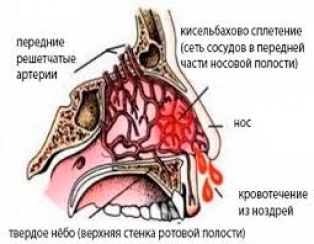 Кровавый я. жалобы на жисть